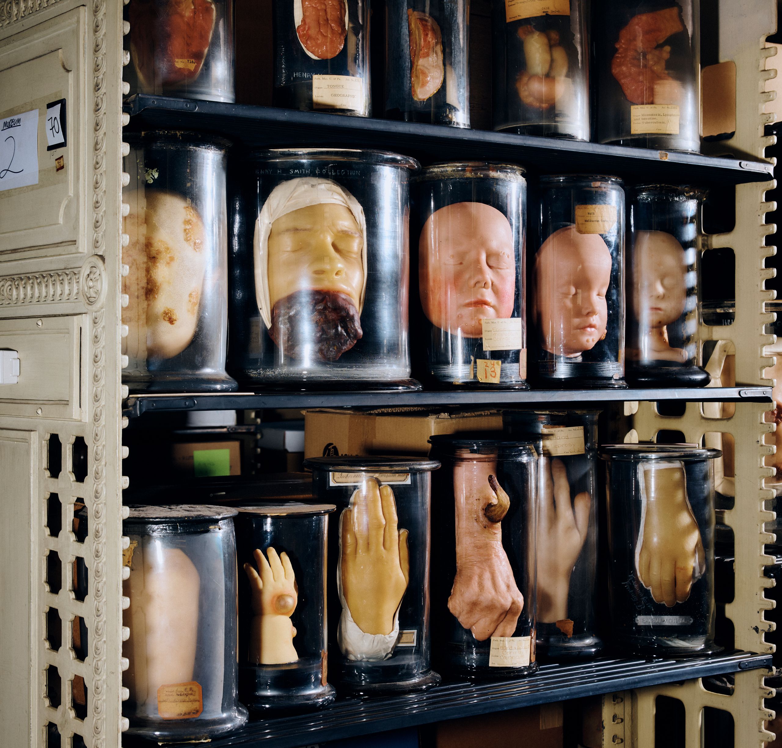 A shelf filled with jars of preserved body parts.